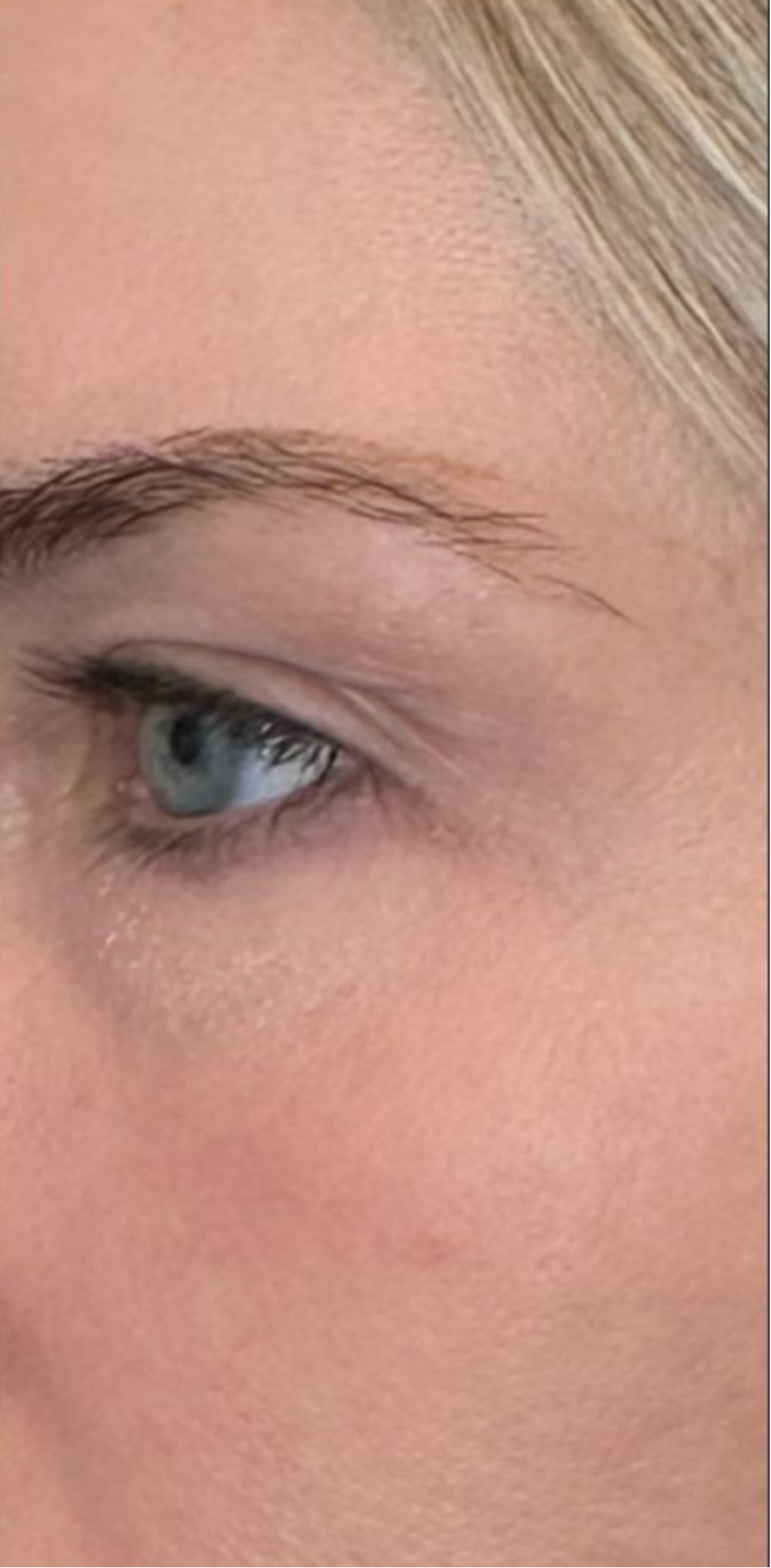 Hydration Intensive