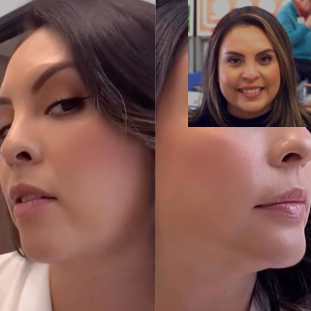 Conforma Reduce & Plump Bundle