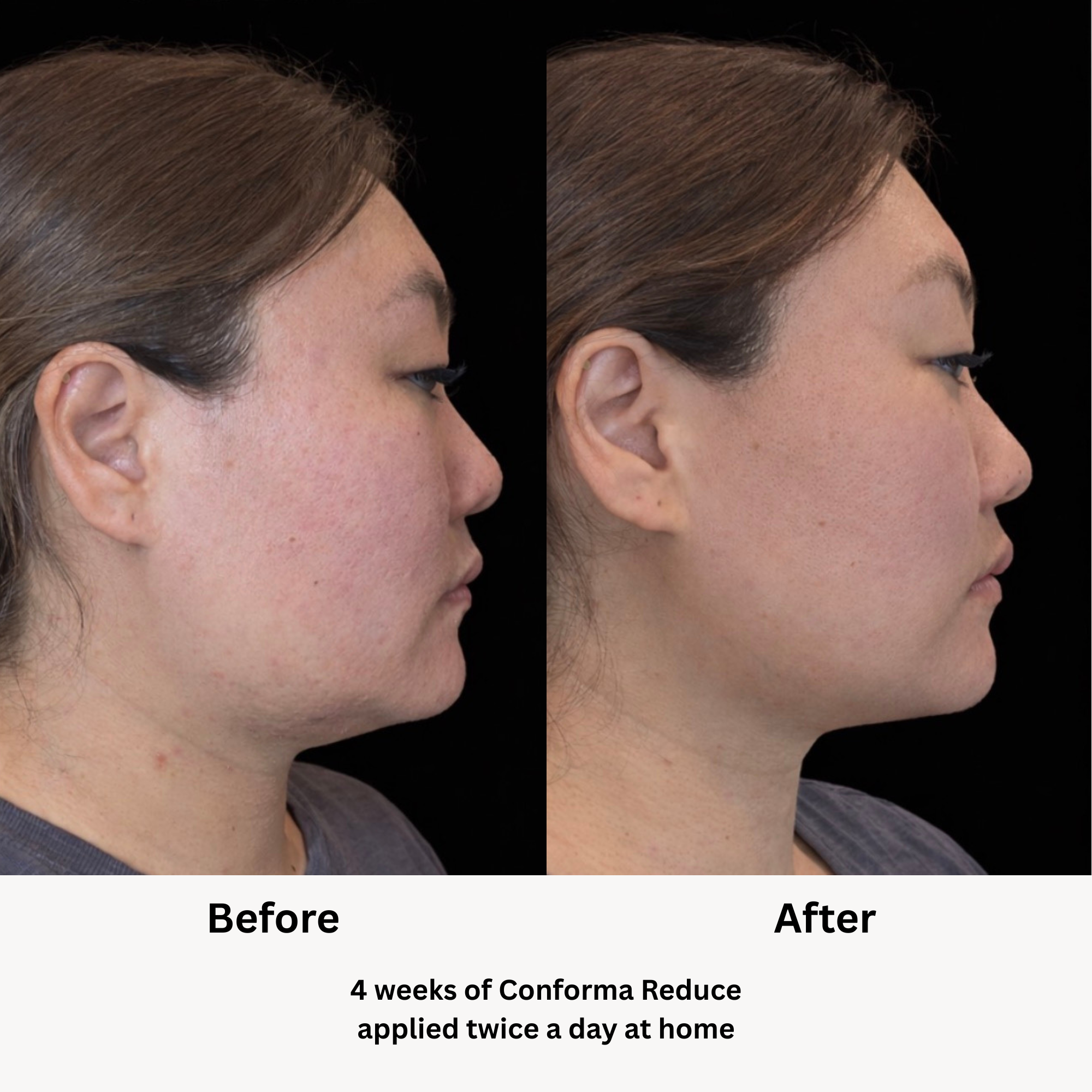 Conforma Reduce