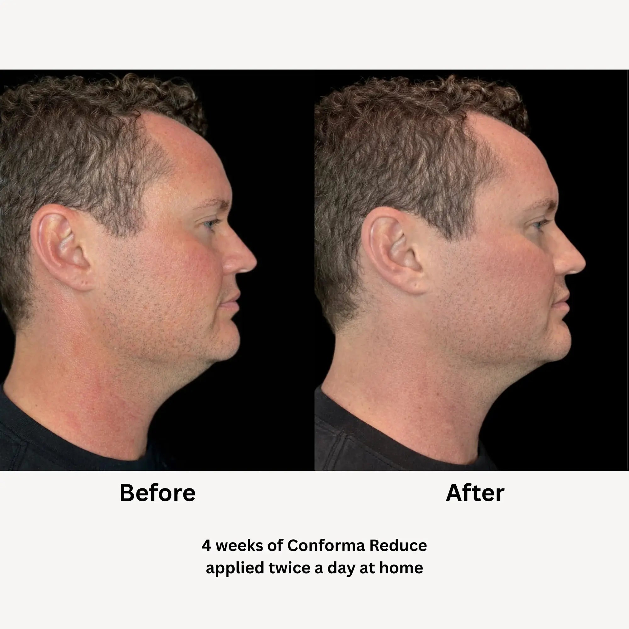 Conforma Reduce