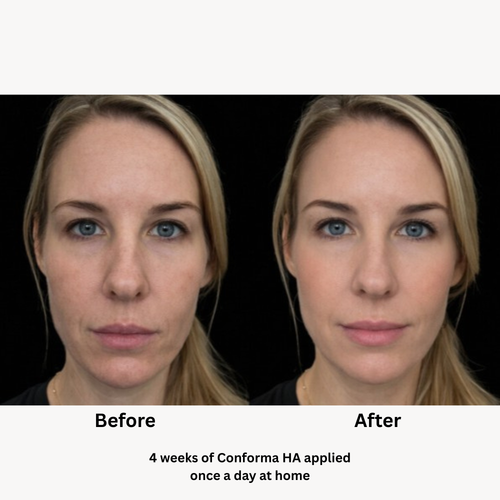 Load image 1 in gallery view. Conforma HA