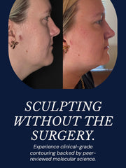 Before-and-after profile photos showing reduced under-chin fullness and a more sculpted jawline, alongside messaging about non-surgical facial contouring.